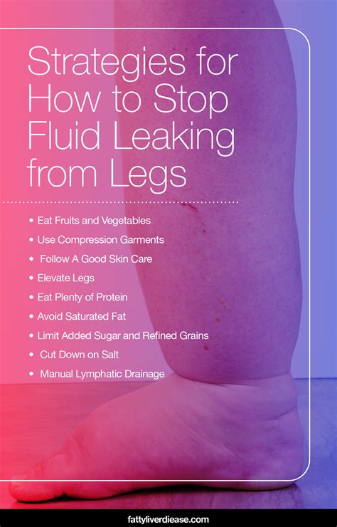 clear fluid leaking from leg|Lymphoedema… It’s not just about ‘leaky legs’